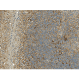 Immunohistochemistry - Anti-Rubicon / Baron Antibody (A304866) - Antibodies.com