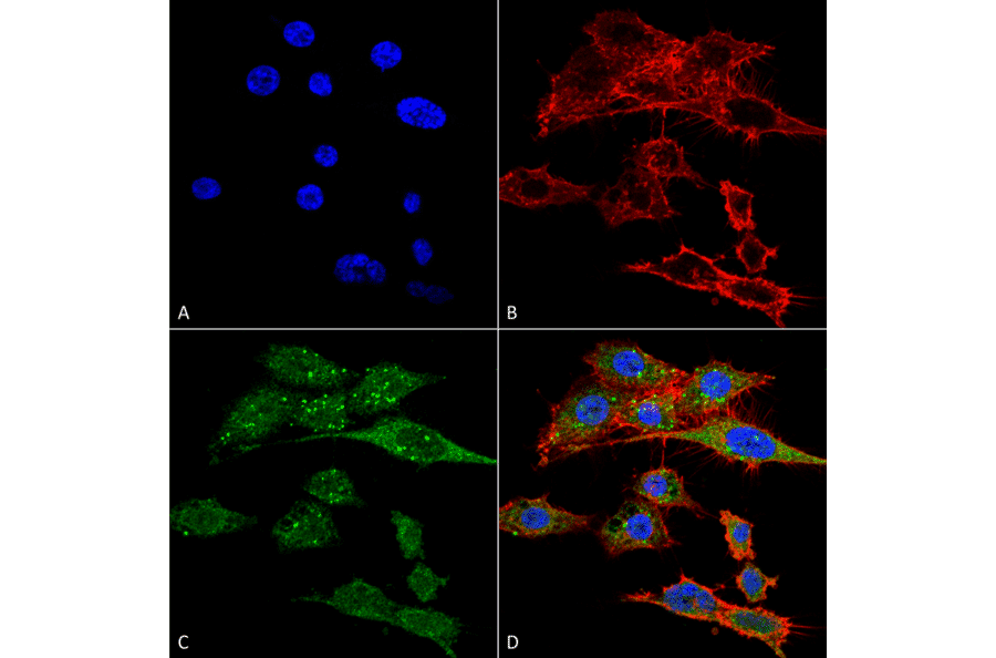 Immunocytochemistry/Immunofluorescence - Anti-Rubicon / Baron Antibody (A304866) - Antibodies.com