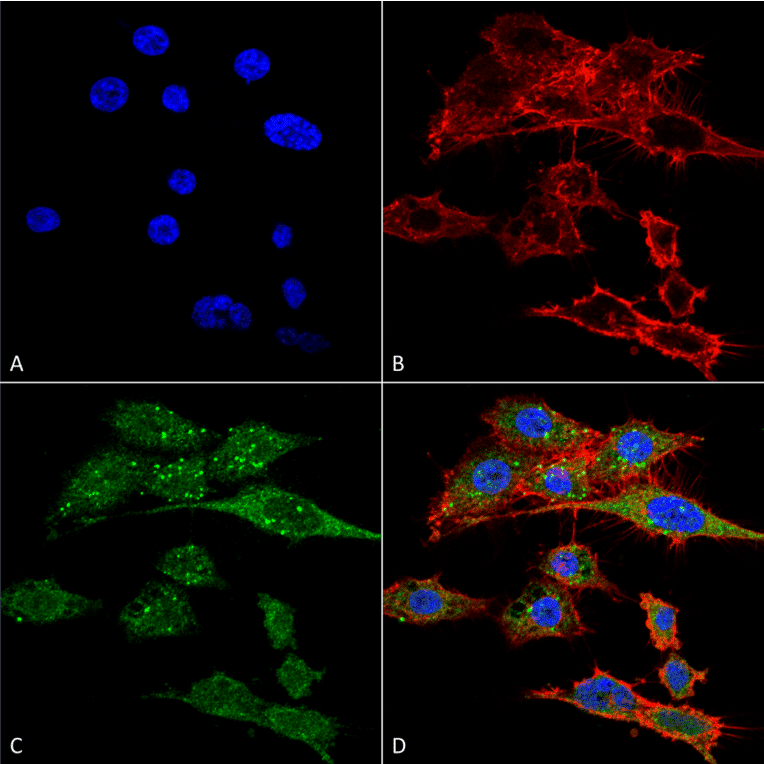 Immunocytochemistry/Immunofluorescence - Anti-Rubicon / Baron Antibody (A304866) - Antibodies.com