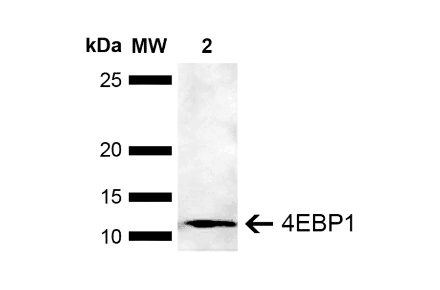 Western Blot - Anti-eIF4EBP1 Antibody (A304867) - Antibodies.com