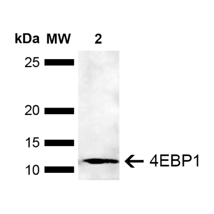 Western Blot - Anti-eIF4EBP1 Antibody (A304867) - Antibodies.com
