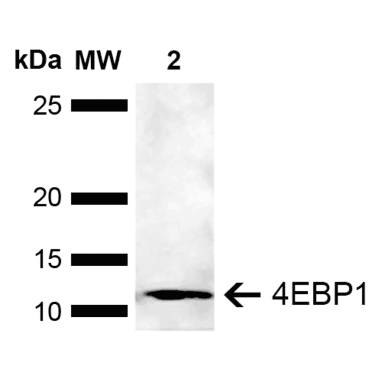 Western Blot - Anti-eIF4EBP1 Antibody (A304867) - Antibodies.com