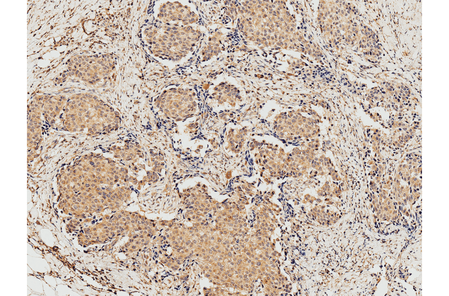 Immunohistochemistry - Anti-eIF4EBP1 Antibody (A304867) - Antibodies.com