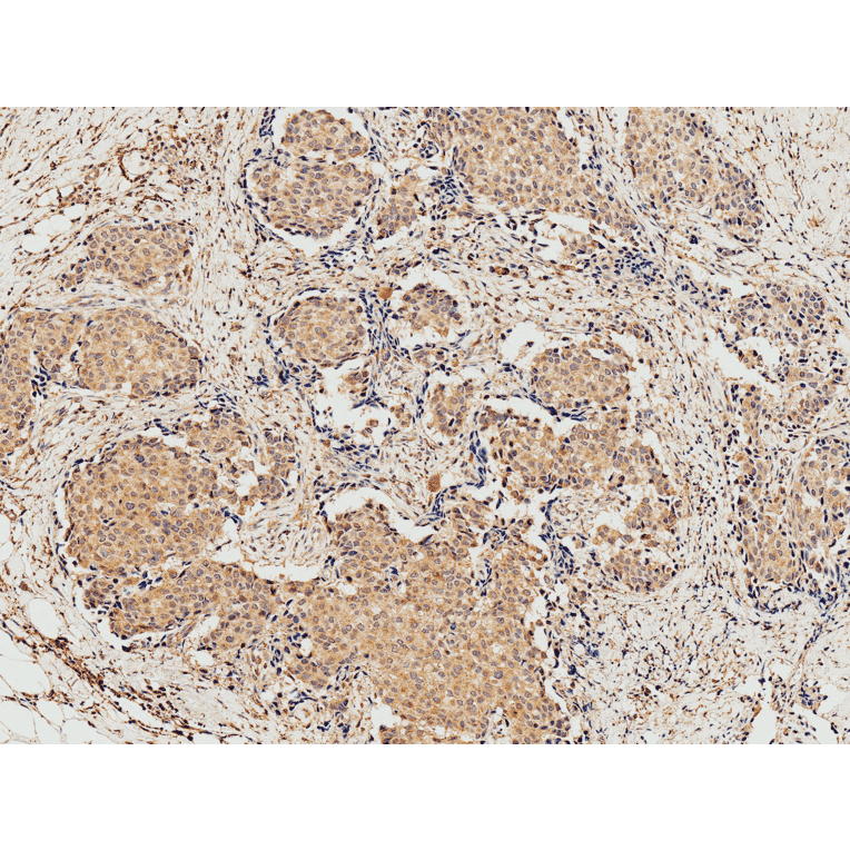 Immunohistochemistry - Anti-eIF4EBP1 Antibody (A304867) - Antibodies.com