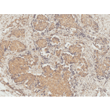 Immunohistochemistry - Anti-eIF4EBP1 Antibody (A304867) - Antibodies.com