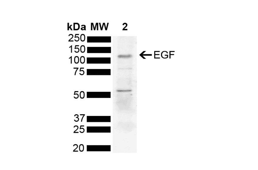 Western Blot - Anti-EGF Antibody (A304868) - Antibodies.com