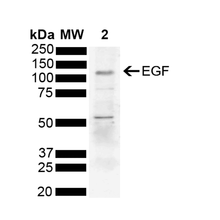 Western Blot - Anti-EGF Antibody (A304868) - Antibodies.com