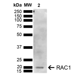 Western Blot - Anti-Rac1 Antibody (A304869) - Antibodies.com
