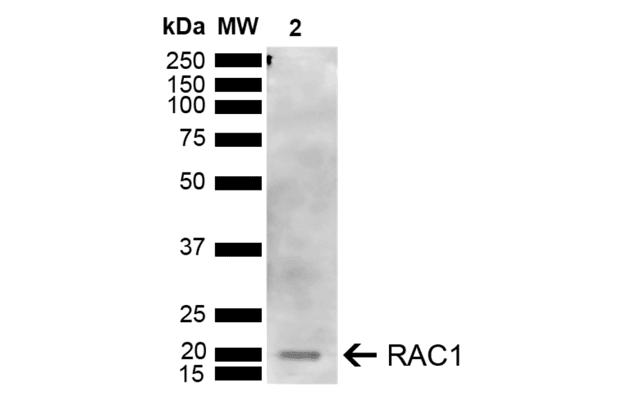 Western Blot - Anti-Rac1 Antibody (A304869) - Antibodies.com