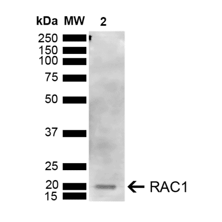 Western Blot - Anti-Rac1 Antibody (A304869) - Antibodies.com