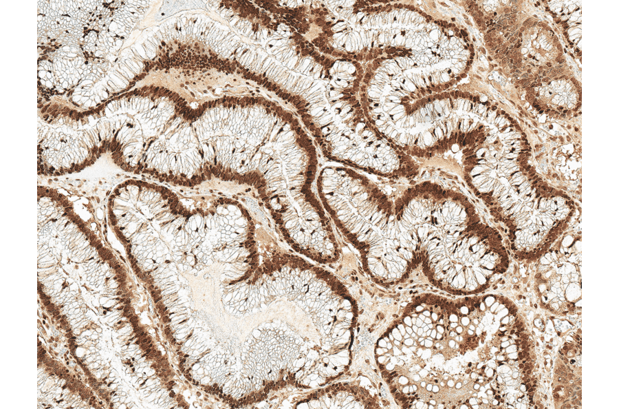 Immunohistochemistry - Anti-Rac1 Antibody (A304869) - Antibodies.com