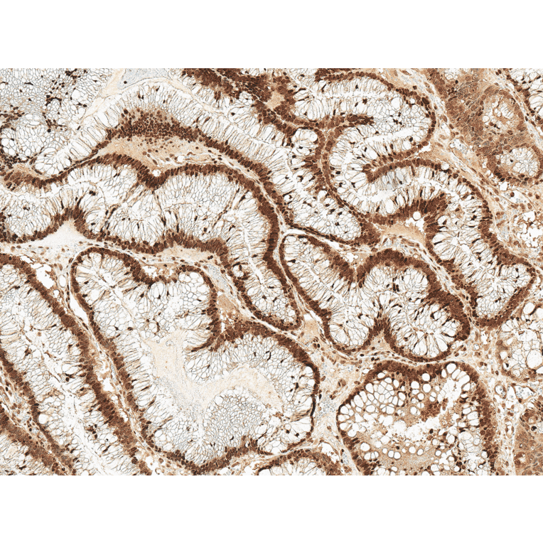 Immunohistochemistry - Anti-Rac1 Antibody (A304869) - Antibodies.com