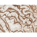 Immunohistochemistry - Anti-Rac1 Antibody (A304869) - Antibodies.com