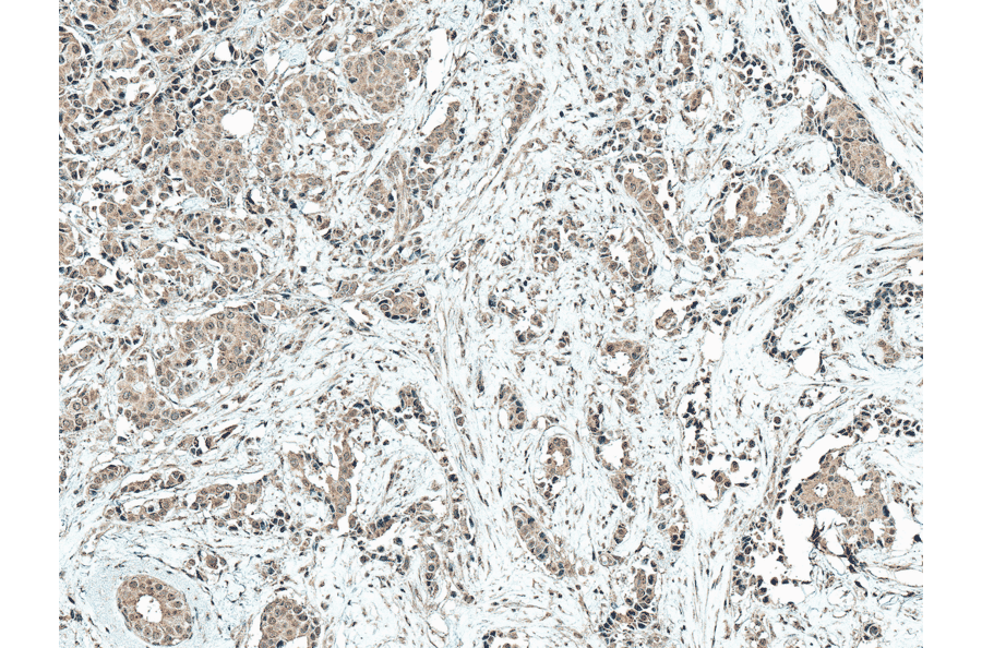 Immunohistochemistry - Anti-CREBBP Antibody (A304870) - Antibodies.com