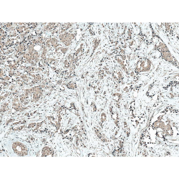 Immunohistochemistry - Anti-CREBBP Antibody (A304870) - Antibodies.com