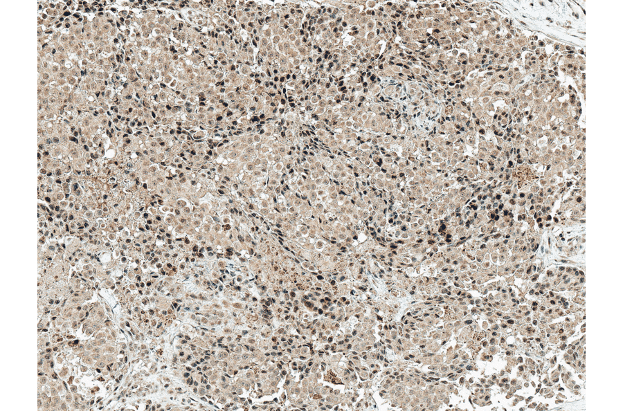 Immunohistochemistry - Anti-CREBBP Antibody (A304870) - Antibodies.com