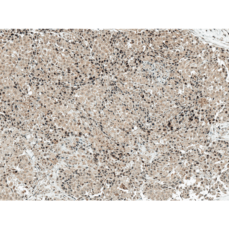 Immunohistochemistry - Anti-CREBBP Antibody (A304870) - Antibodies.com