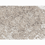 Immunohistochemistry - Anti-CREBBP Antibody (A304870) - Antibodies.com