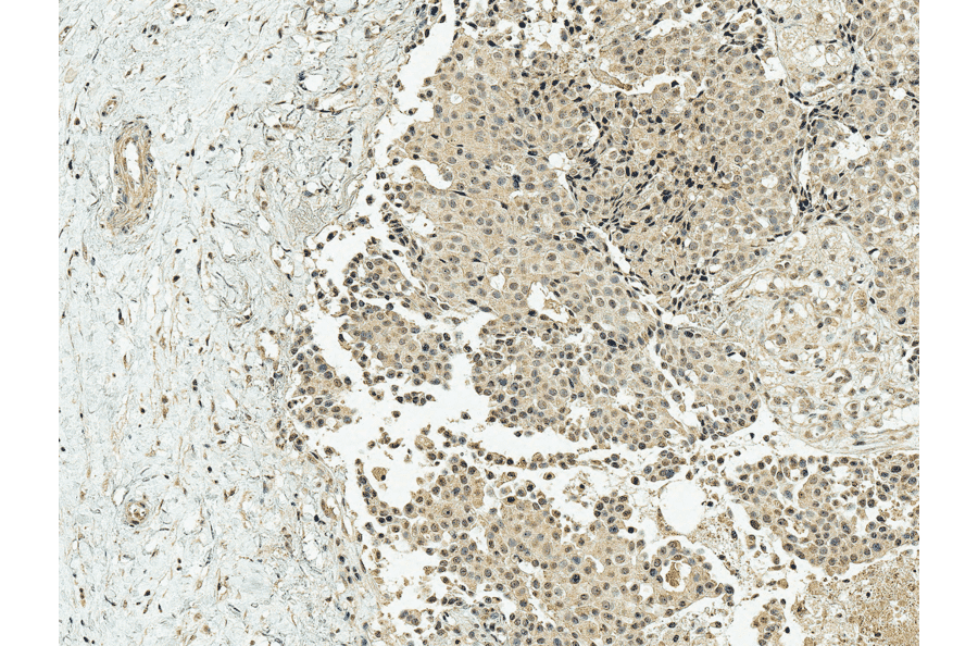Immunohistochemistry - Anti-CREBBP Antibody (A304871) - Antibodies.com