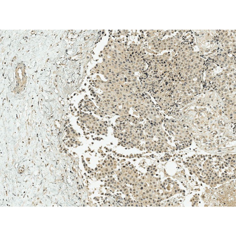Immunohistochemistry - Anti-CREBBP Antibody (A304871) - Antibodies.com