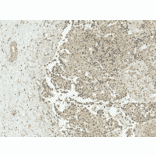 Immunohistochemistry - Anti-CREBBP Antibody (A304871) - Antibodies.com