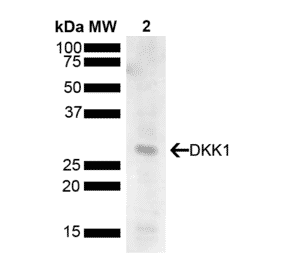 Western Blot - Anti-DKK1 Antibody (A304872) - Antibodies.com