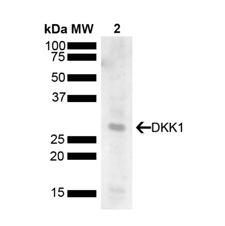 Western Blot - Anti-DKK1 Antibody (A304872) - Antibodies.com