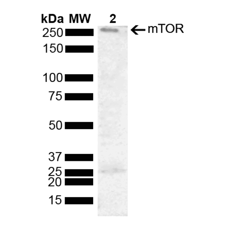 Western Blot - Anti-mTOR Antibody (A304873) - Antibodies.com