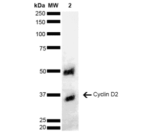 Western Blot - Anti-Cyclin D2 Antibody (A304874) - Antibodies.com