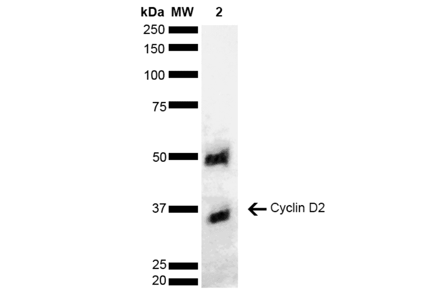 Western Blot - Anti-Cyclin D2 Antibody (A304874) - Antibodies.com