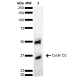 Western Blot - Anti-Cyclin D2 Antibody (A304874) - Antibodies.com