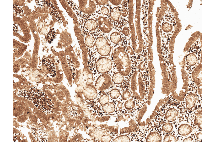 Immunohistochemistry - Anti-Cyclin D2 Antibody (A304874) - Antibodies.com
