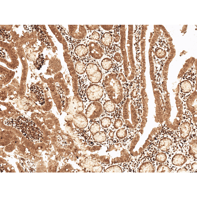 Immunohistochemistry - Anti-Cyclin D2 Antibody (A304874) - Antibodies.com