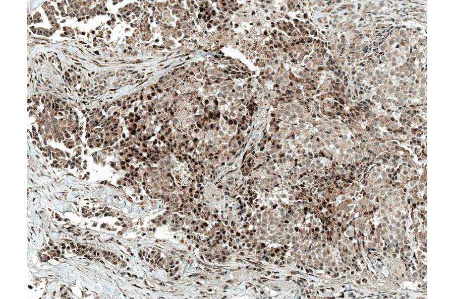 Immunohistochemistry - Anti-c-Jun Antibody (A304877) - Antibodies.com