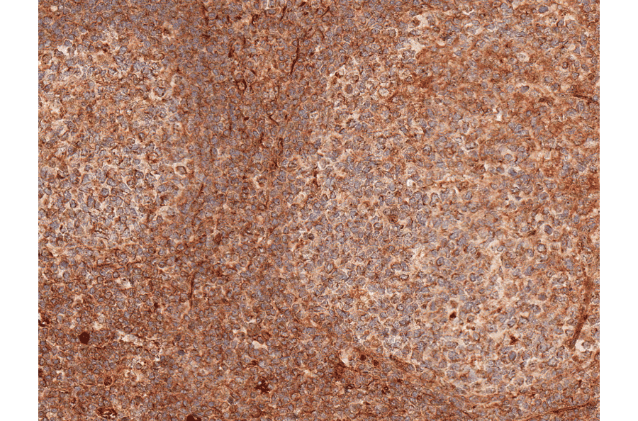 Immunohistochemistry - Anti-TCF7 Antibody (A304878) - Antibodies.com