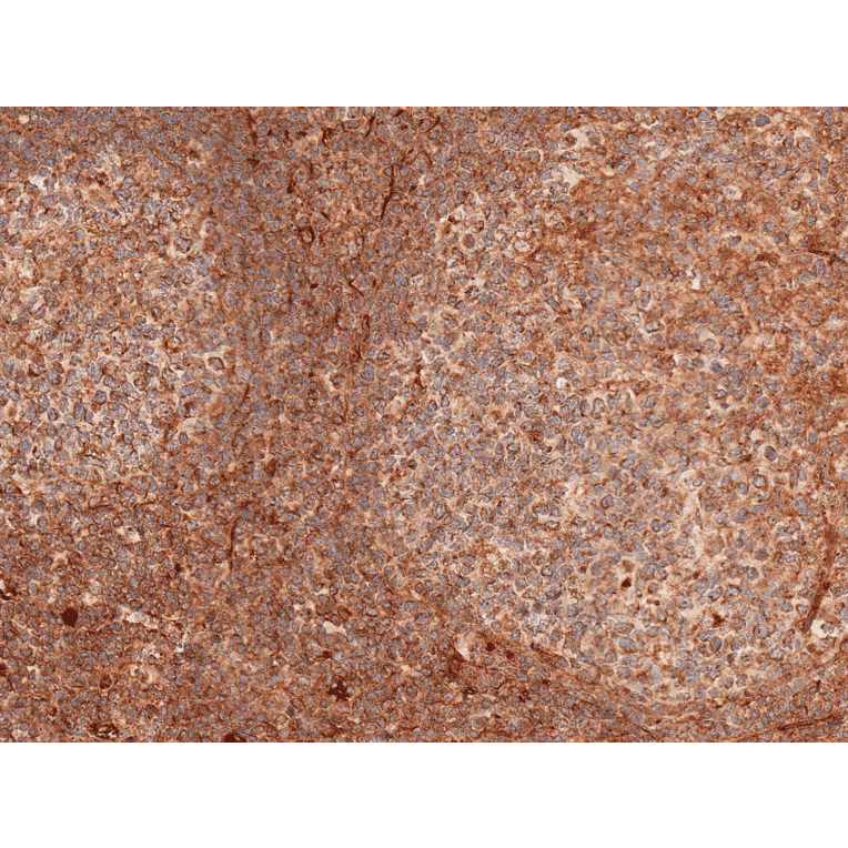 Immunohistochemistry - Anti-TCF7 Antibody (A304878) - Antibodies.com