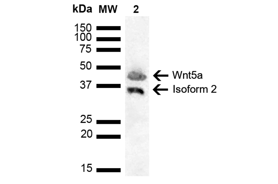 Western Blot - Anti-Wnt5a Antibody (A304879) - Antibodies.com