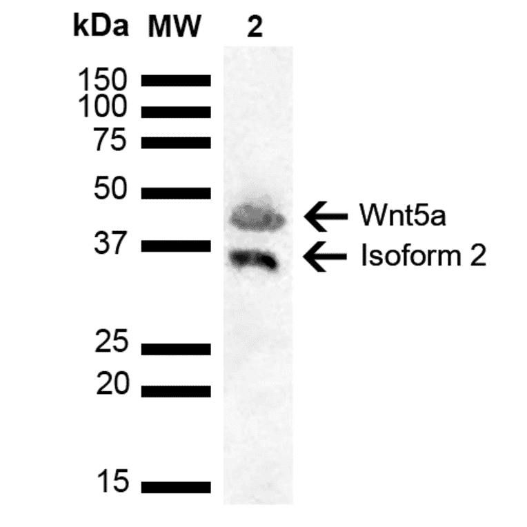 Western Blot - Anti-Wnt5a Antibody (A304879) - Antibodies.com