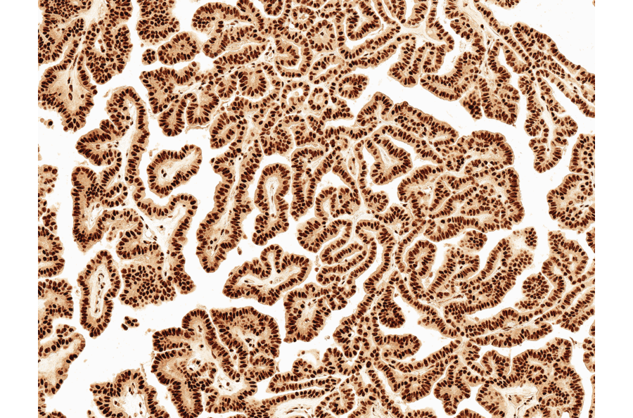 Immunohistochemistry - Anti-Wnt5a Antibody (A304879) - Antibodies.com