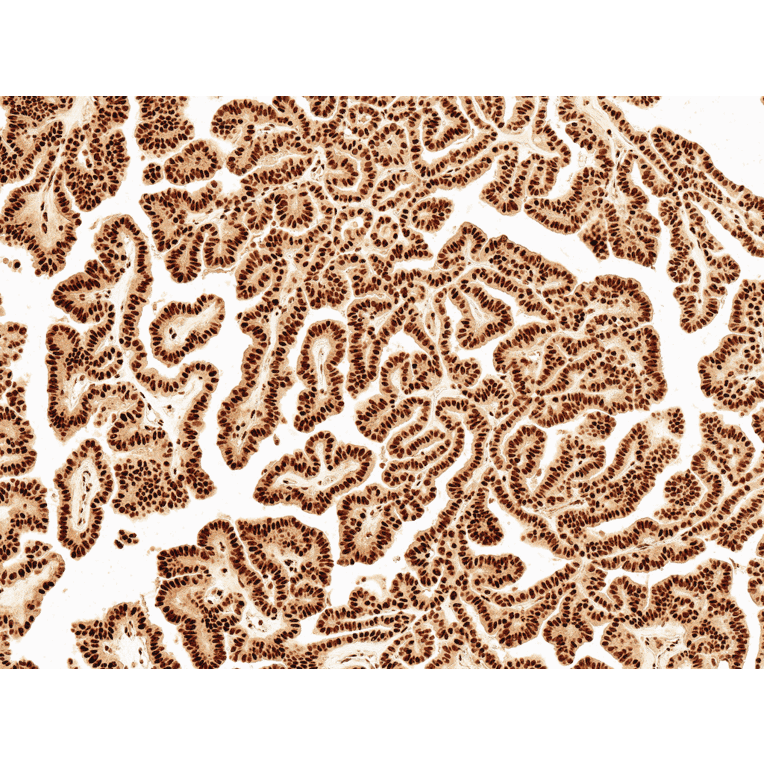 Immunohistochemistry - Anti-Wnt5a Antibody (A304879) - Antibodies.com