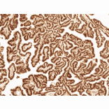 Immunohistochemistry - Anti-Wnt5a Antibody (A304879) - Antibodies.com