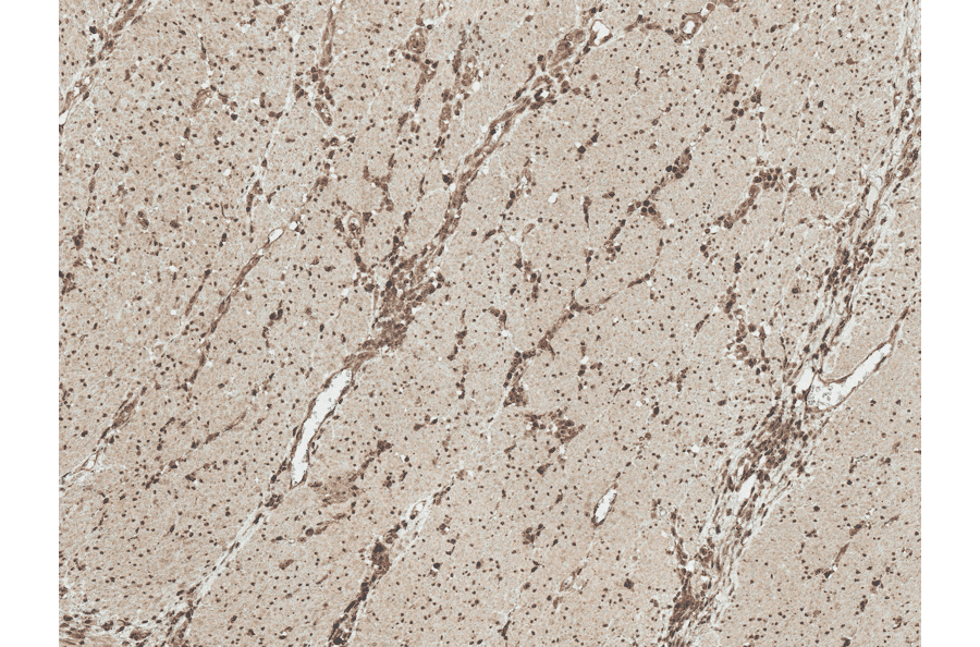 Immunohistochemistry - Anti-MEK1 Antibody (A304880) - Antibodies.com