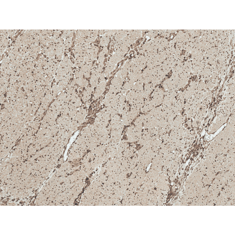 Immunohistochemistry - Anti-MEK1 Antibody (A304880) - Antibodies.com