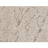 Immunohistochemistry - Anti-MEK1 Antibody (A304880) - Antibodies.com