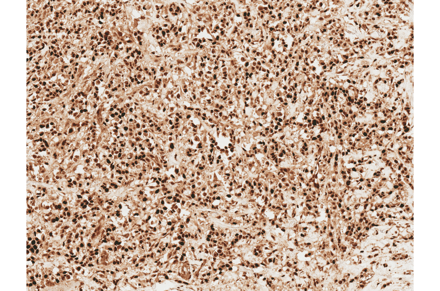 Immunohistochemistry - Anti-Wnt1 Antibody (A304883) - Antibodies.com