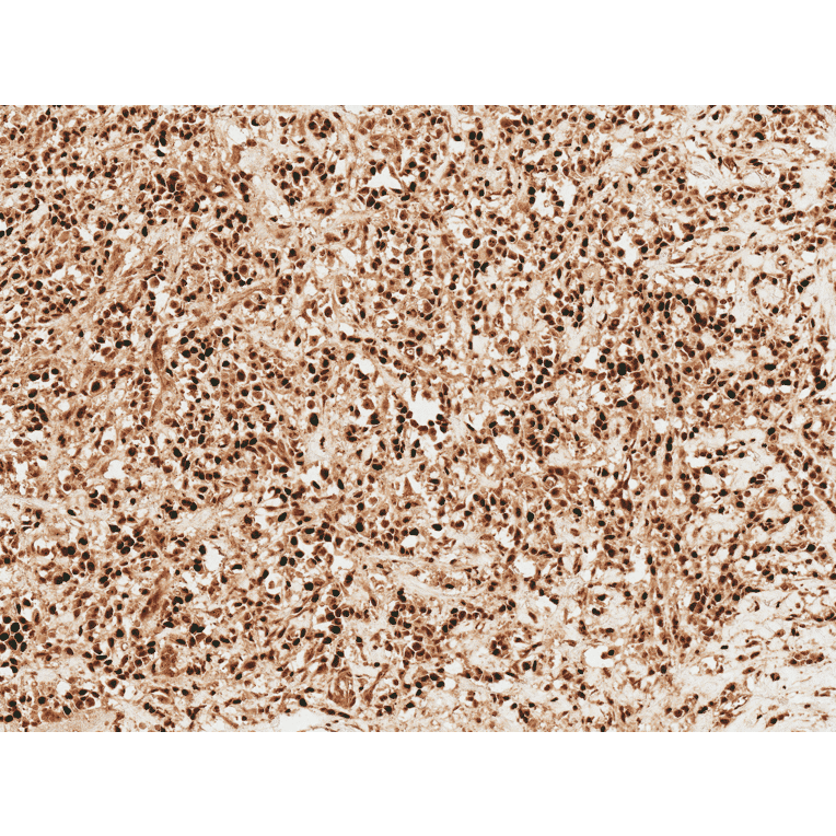 Immunohistochemistry - Anti-Wnt1 Antibody (A304883) - Antibodies.com