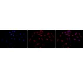 Immunocytochemistry/Immunofluorescence - Anti-HSP47 Antibody [1C4-1A6] (A304884) - Antibodies.com