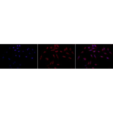 Immunocytochemistry/Immunofluorescence - Anti-HSP47 Antibody [1C4-1A6] (A304884) - Antibodies.com