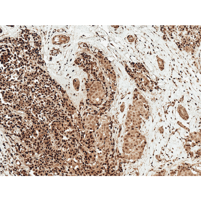Immunohistochemistry - Anti-c-Myc Antibody (A304886) - Antibodies.com