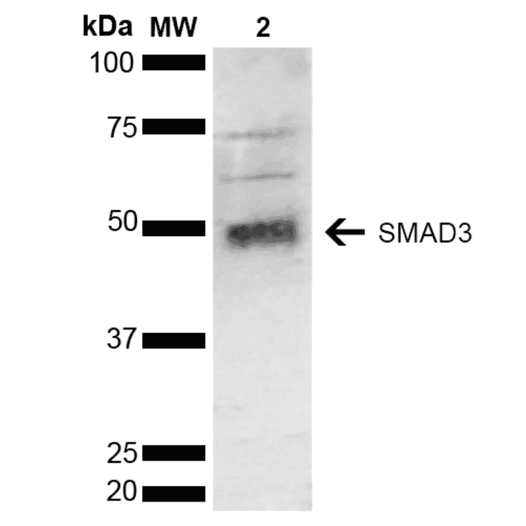 Western Blot - Anti-Smad3 Antibody (A304887) - Antibodies.com